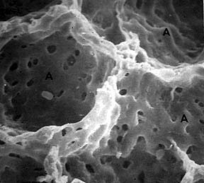 Pores de Kohn