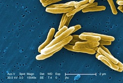Mycobacterium tuberculosis au microscope électronique