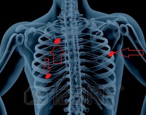 Illustration du site Respiliège