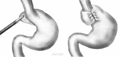 Gray's Anatomy 2007 (le livre, pas la série!)