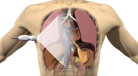 Illustration du site Respiliège