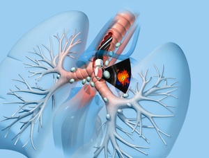 Illustration du site Respiliège