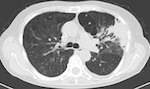 Carte des centres de radiologie